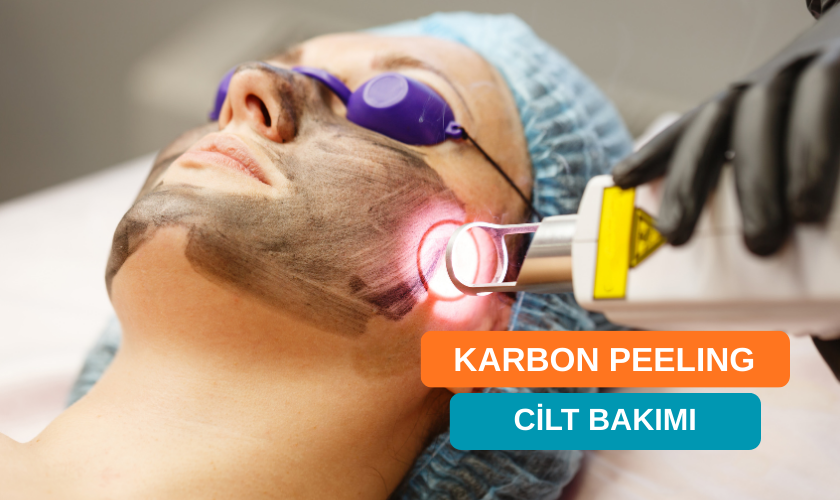 Karbon Peeling Nedir? Leke ve Gözenek Tedavisi